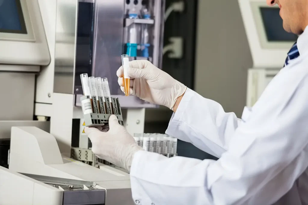 A lab tech holding a plastic container of a patient's sample, getting ready for testing and analysis. Healthcare fraud concept.